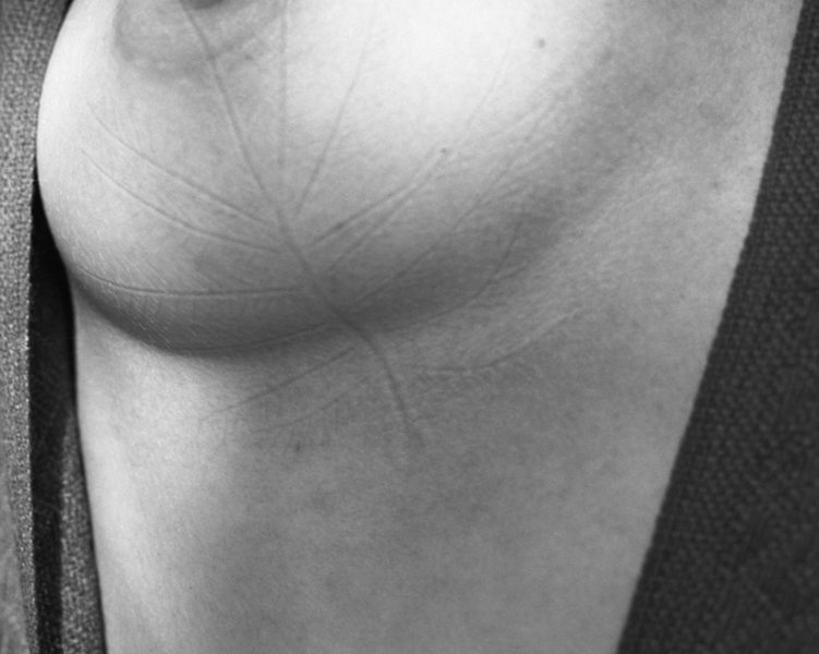 Study of Traces